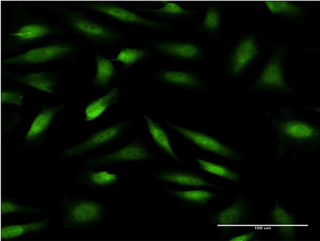 ZNF274 Antibody in Immunocytochemistry (ICC/IF)