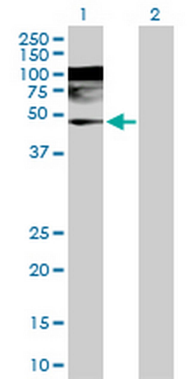 WDR4 Antibody in Western Blot (WB)