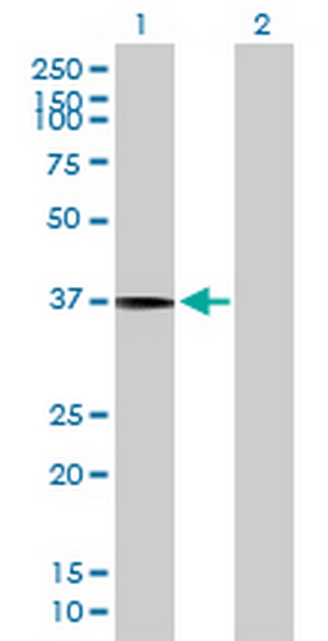 SLC17A3 Antibody in Western Blot (WB)