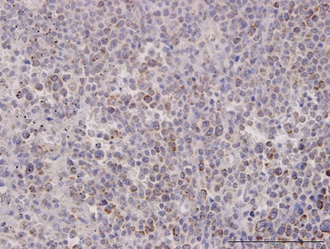 MTHFD2 Antibody in Immunohistochemistry (Paraffin) (IHC (P))