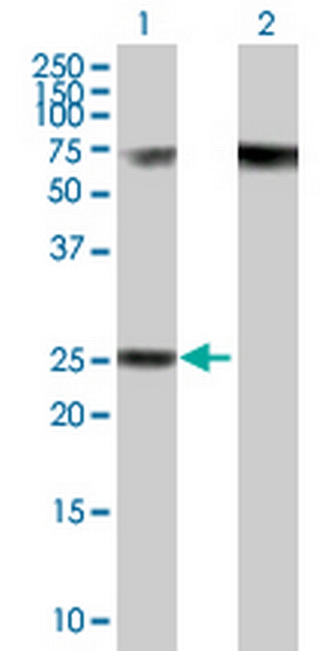 RPP40 Antibody in Western Blot (WB)