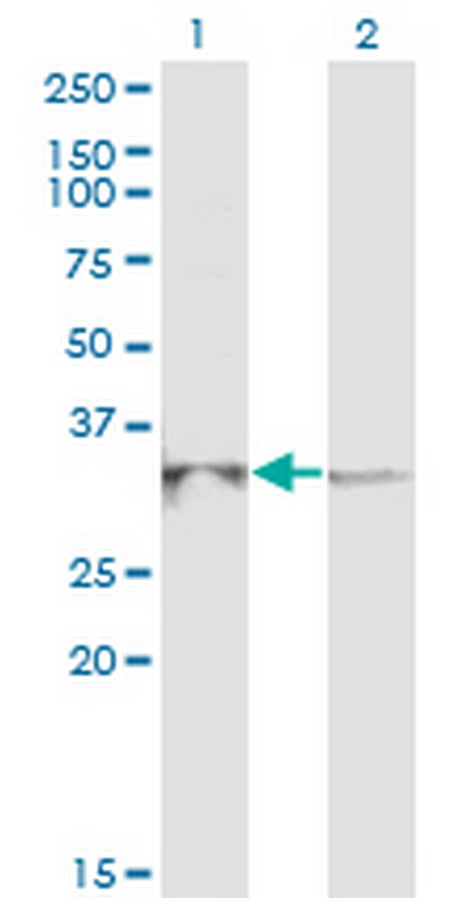 RPP40 Antibody in Western Blot (WB)