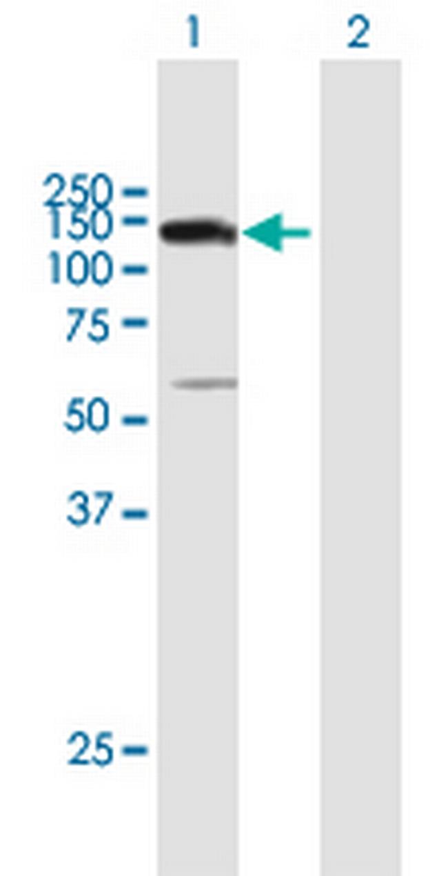 UTP14A Antibody in Western Blot (WB)