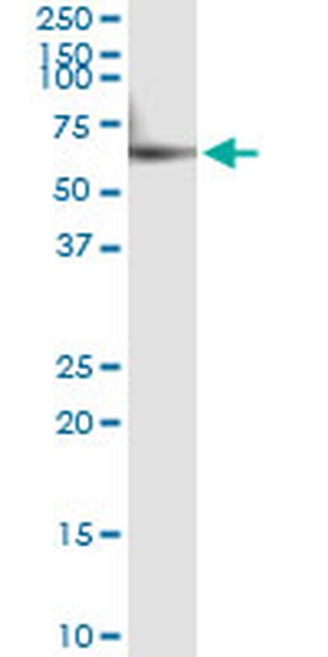 CYP46A1 Antibody in Immunoprecipitation (IP)