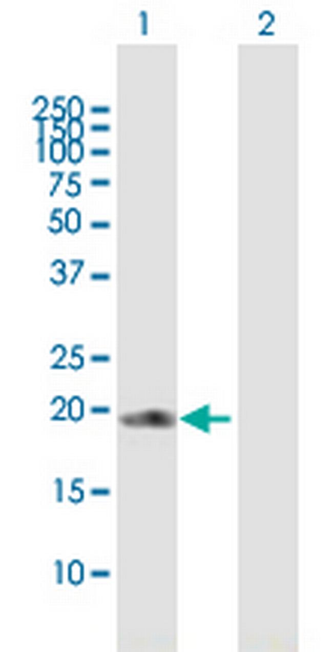 COPS8 Antibody in Western Blot (WB)