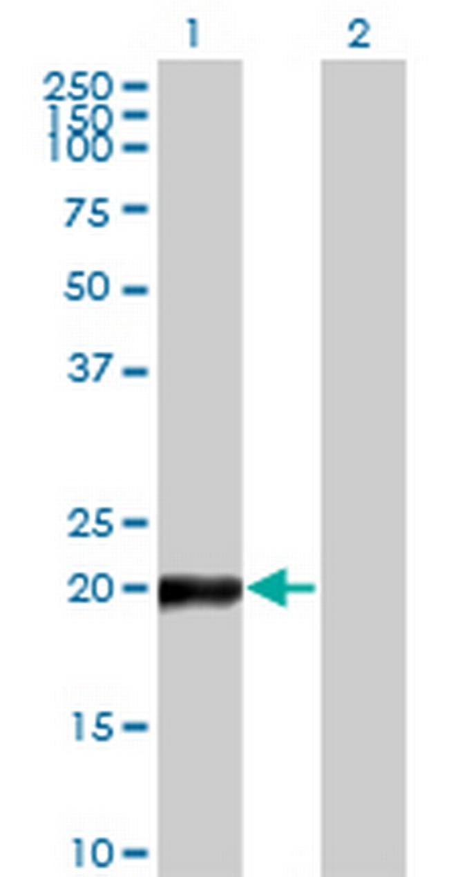 COPS8 Antibody in Western Blot (WB)