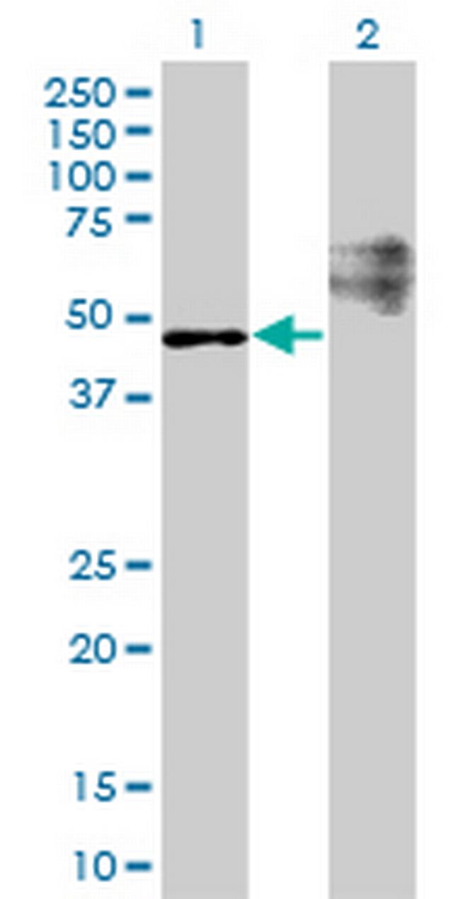 STARD3 Antibody in Western Blot (WB)