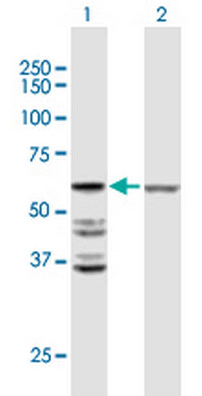 ACOT2 Antibody in Western Blot (WB)