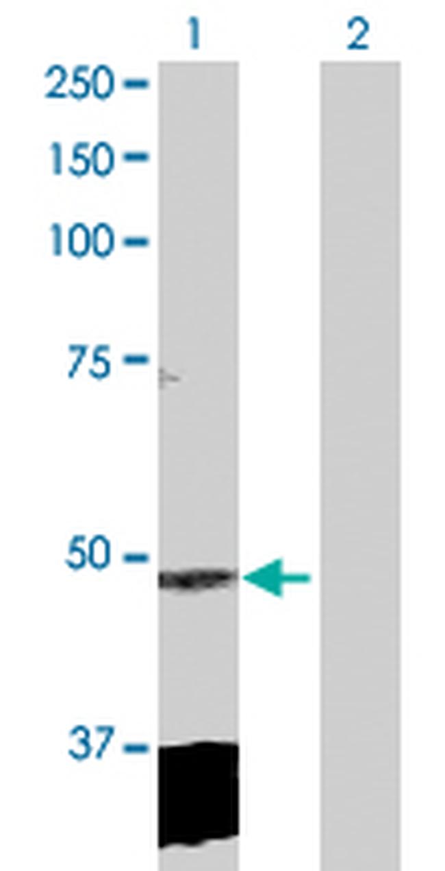 CLP1 Antibody in Western Blot (WB)