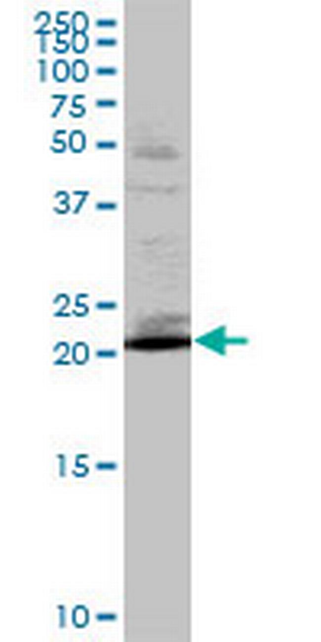 RAB32 Antibody in Western Blot (WB)