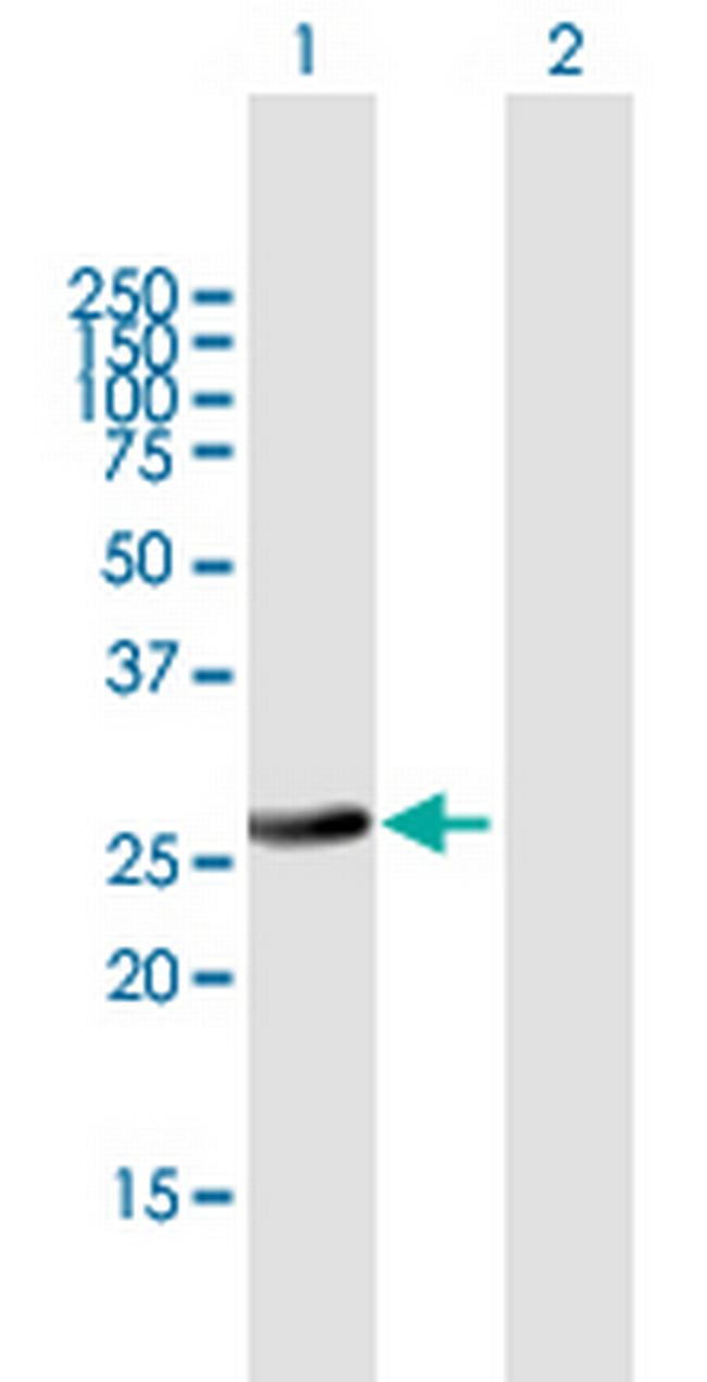 RAB32 Antibody in Western Blot (WB)