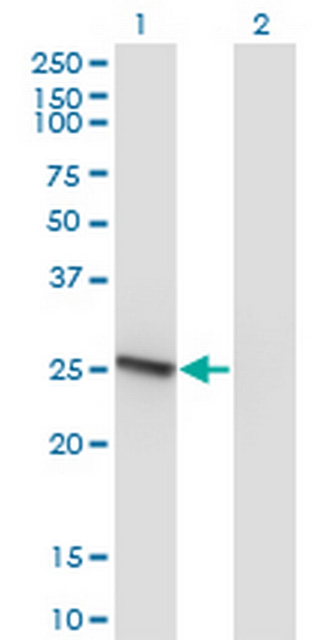 RAB32 Antibody in Western Blot (WB)