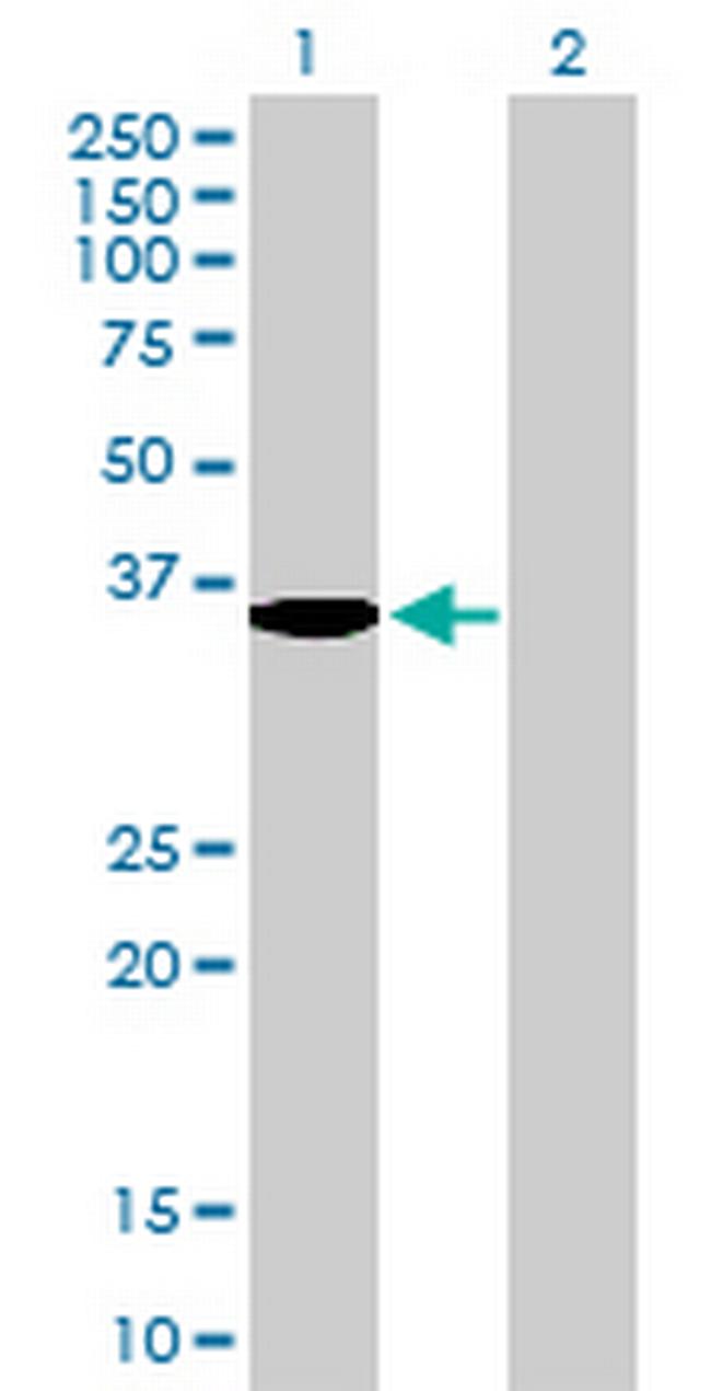 SDS Antibody in Western Blot (WB)