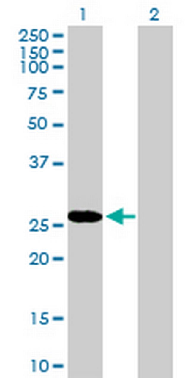 RBPMS Antibody in Western Blot (WB)