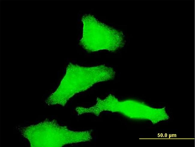 RAB31 Antibody in Immunocytochemistry (ICC/IF)