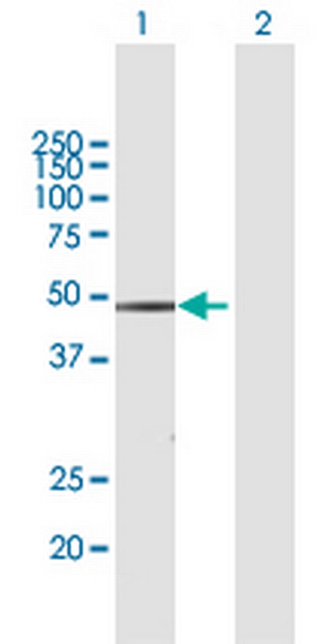 WWP2 Antibody in Western Blot (WB)