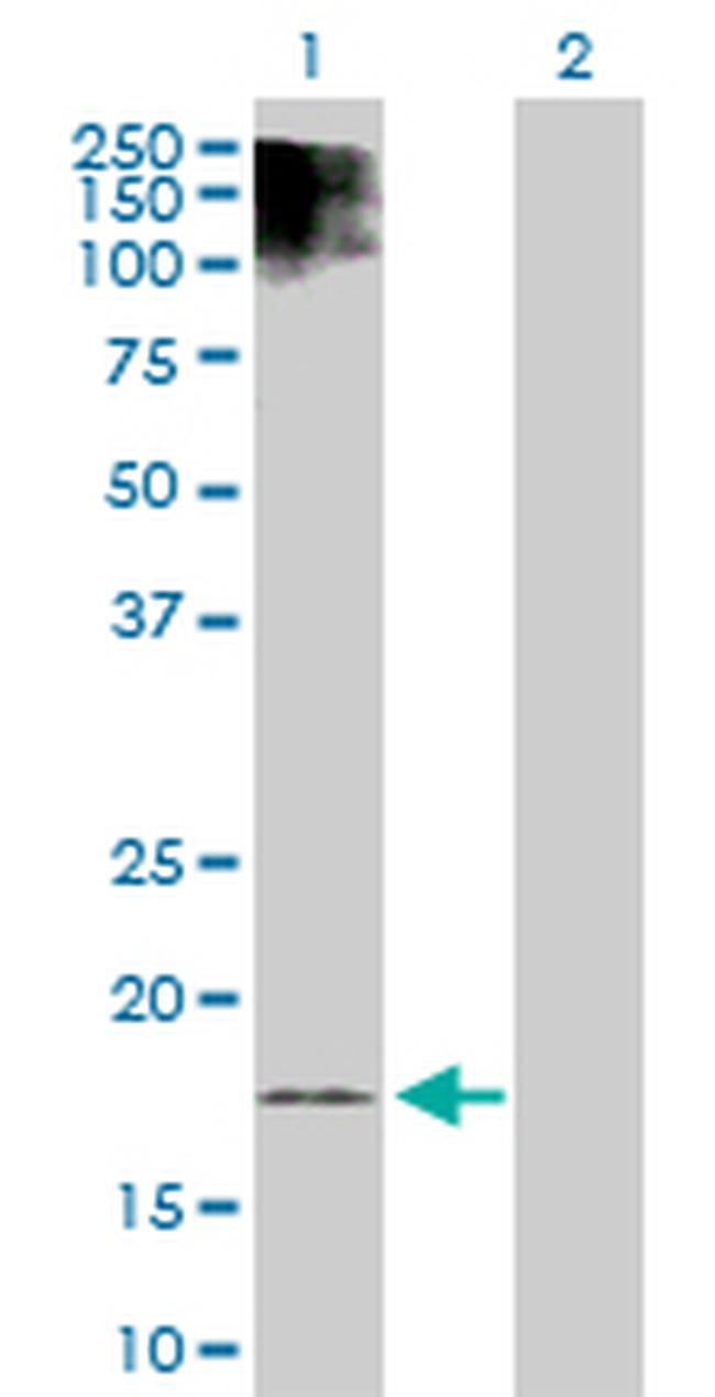 ESM1 Antibody in Western Blot (WB)