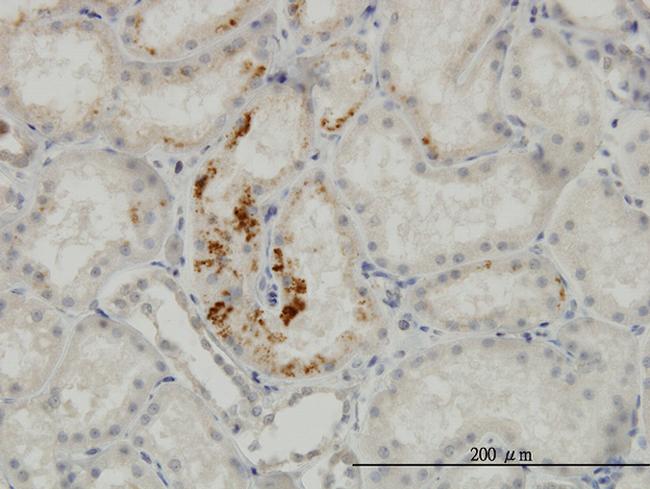 ESM1 Antibody in Immunohistochemistry (Paraffin) (IHC (P))