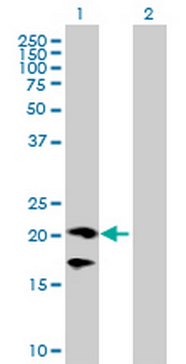 CD160 Antibody in Western Blot (WB)