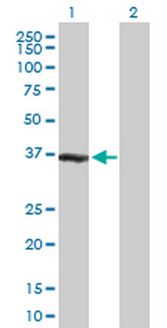 ZWINT Antibody in Western Blot (WB)