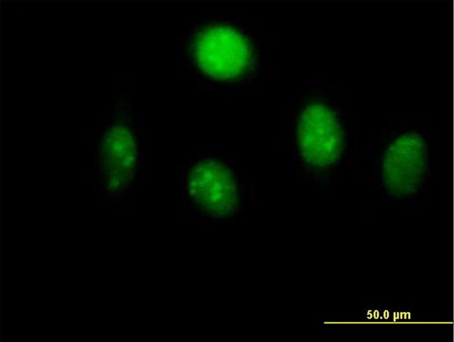 MYST2 Antibody in Immunocytochemistry (ICC/IF)