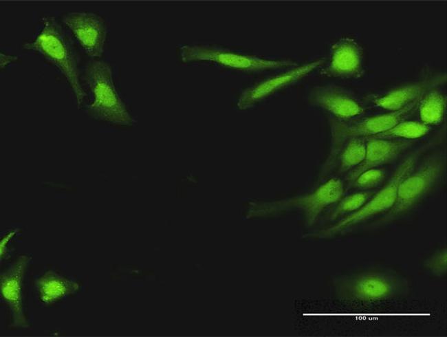 HRASLS3 Antibody in Immunocytochemistry (ICC/IF)