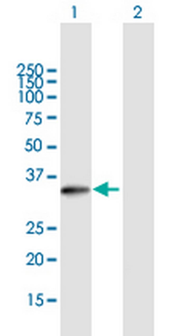 LDB3 Antibody in Western Blot (WB)