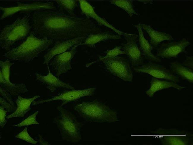 NUDT5 Antibody in Immunocytochemistry (ICC/IF)