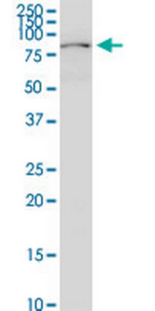 PKP3 Antibody in Western Blot (WB)