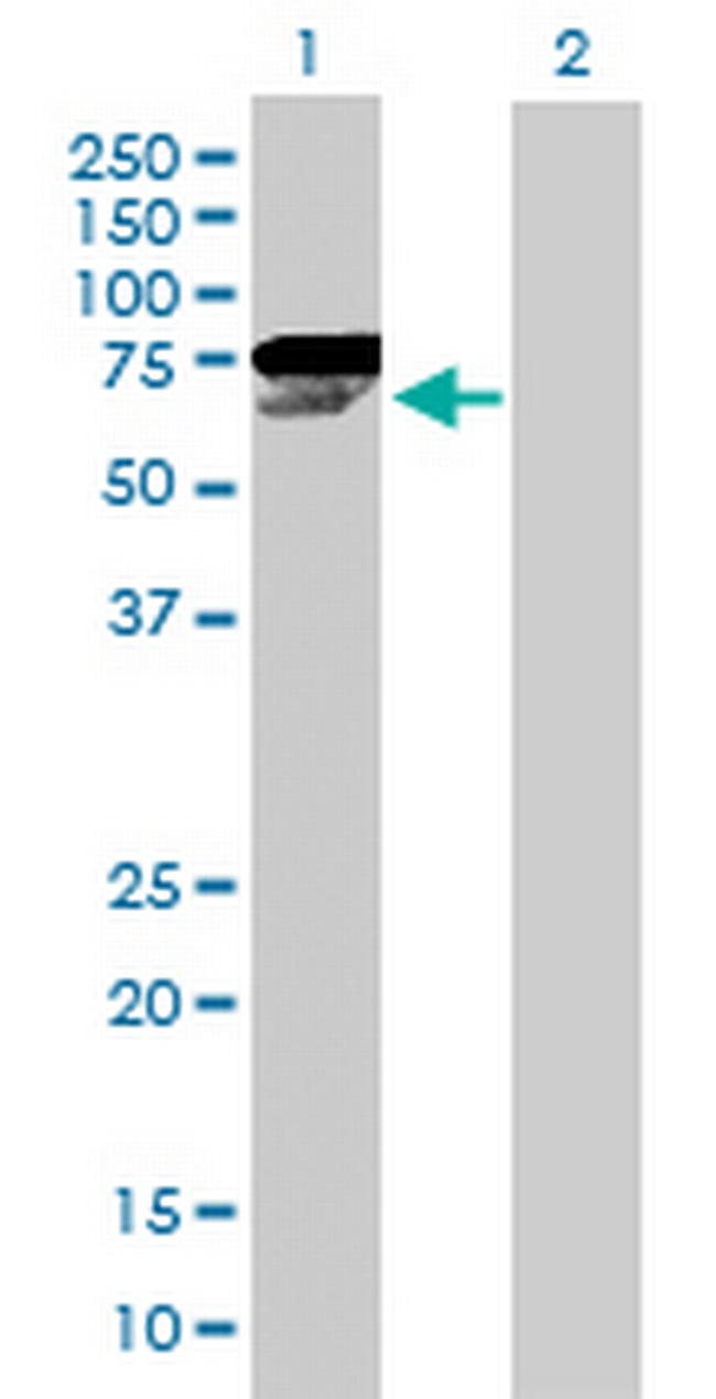 CHEK2 Antibody in Western Blot (WB)