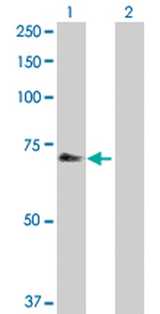 CHEK2 Antibody in Western Blot (WB)