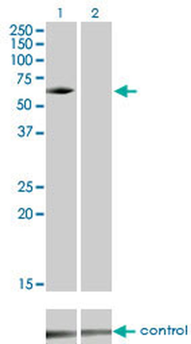 IRAK3 Antibody in Western Blot (WB)