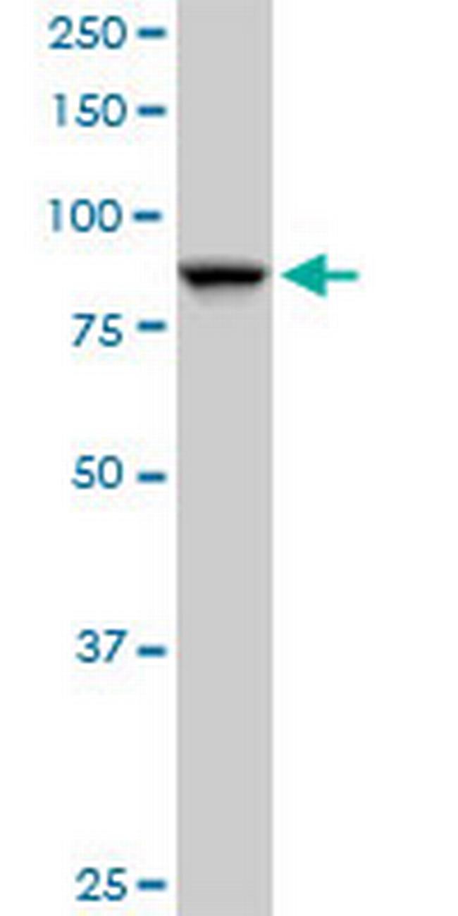 SEC63 Antibody in Western Blot (WB)