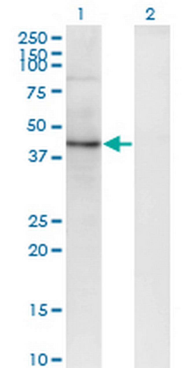 SEC63 Antibody in Western Blot (WB)