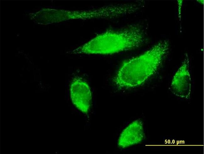 POLG2 Antibody in Immunocytochemistry (ICC/IF)