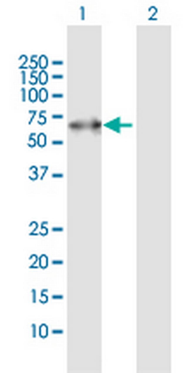 PACSIN2 Antibody in Western Blot (WB)