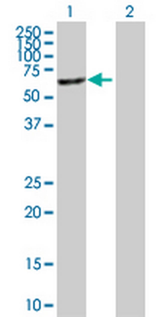 MGAT4B Antibody in Western Blot (WB)