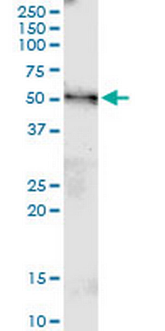 MGAT4B Antibody in Western Blot (WB)