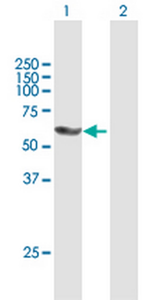 PNKP Antibody in Western Blot (WB)