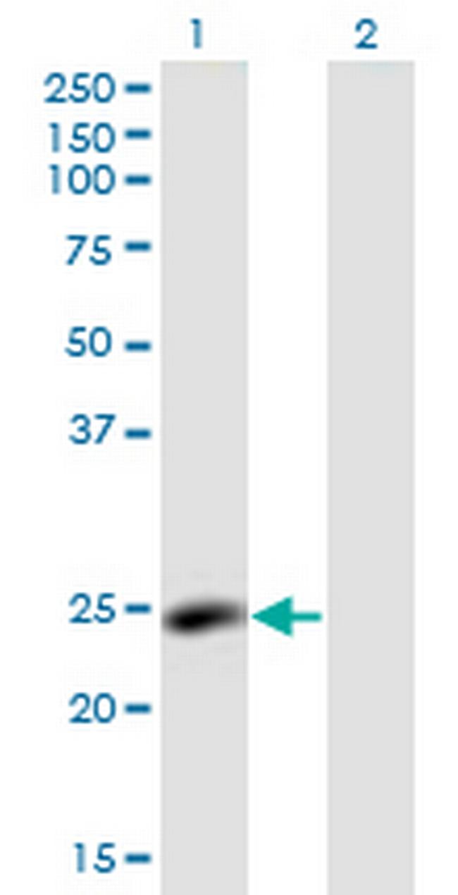 LYPLA2 Antibody in Western Blot (WB)