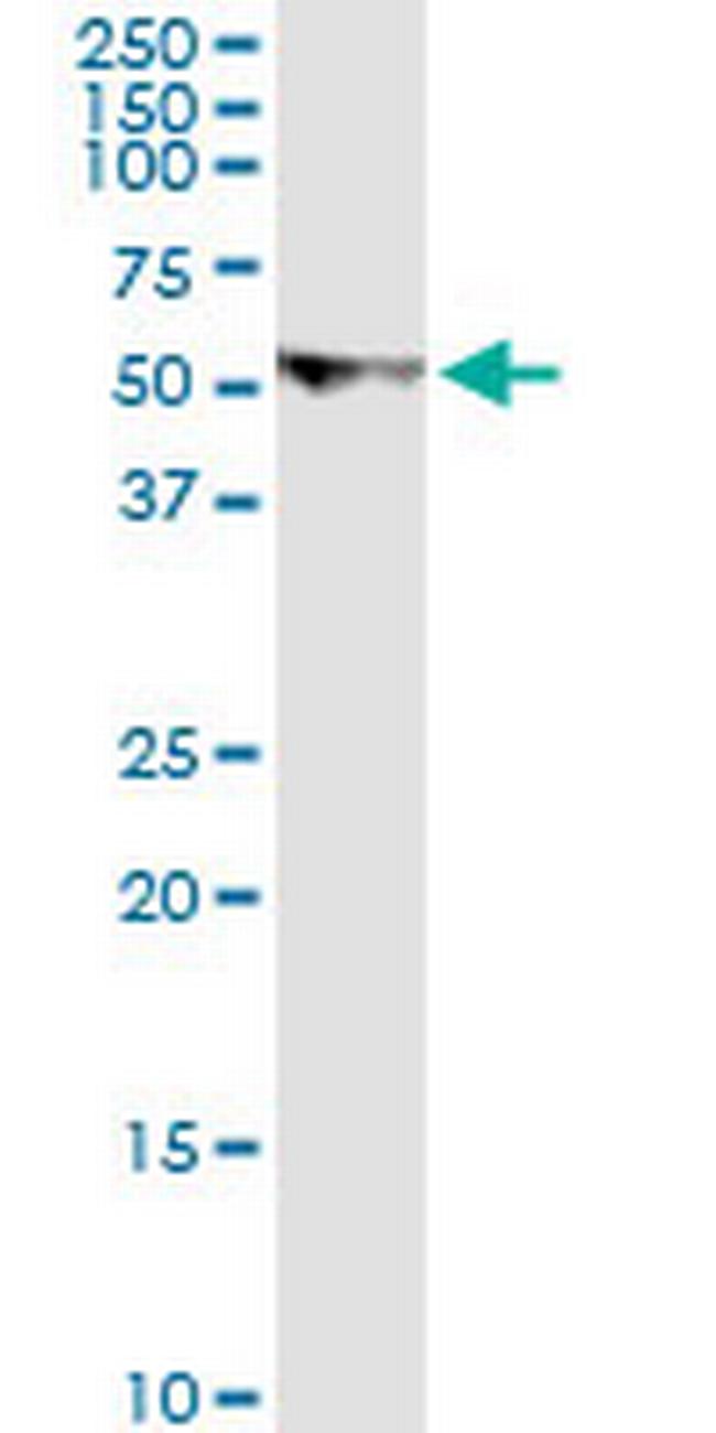 U2AF2 Antibody in Western Blot (WB)