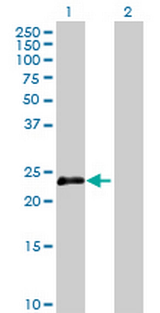 OIP5 Antibody in Western Blot (WB)