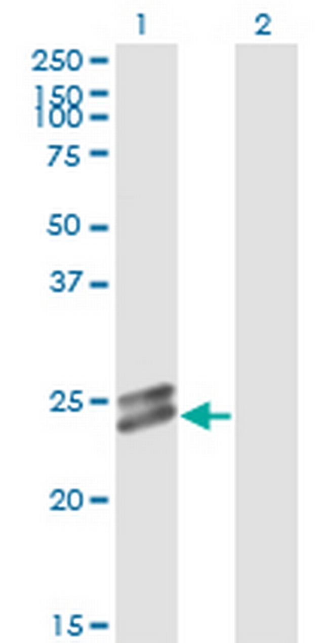 OIP5 Antibody in Western Blot (WB)