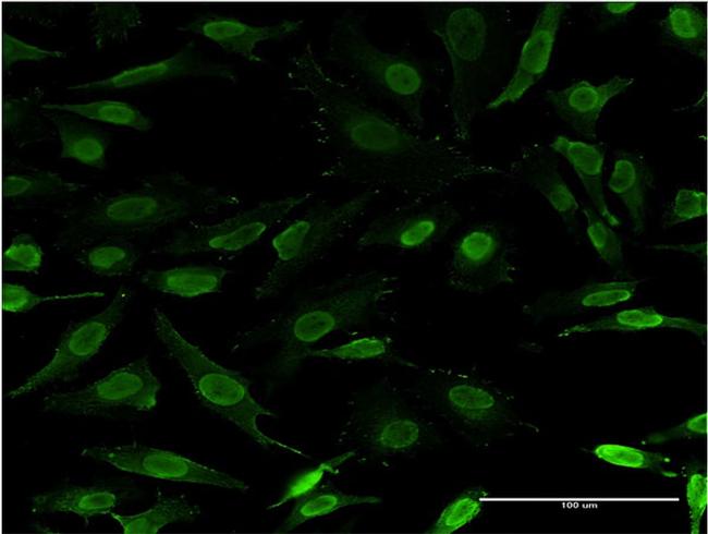 ZNFN1A3 Antibody in Immunocytochemistry (ICC/IF)