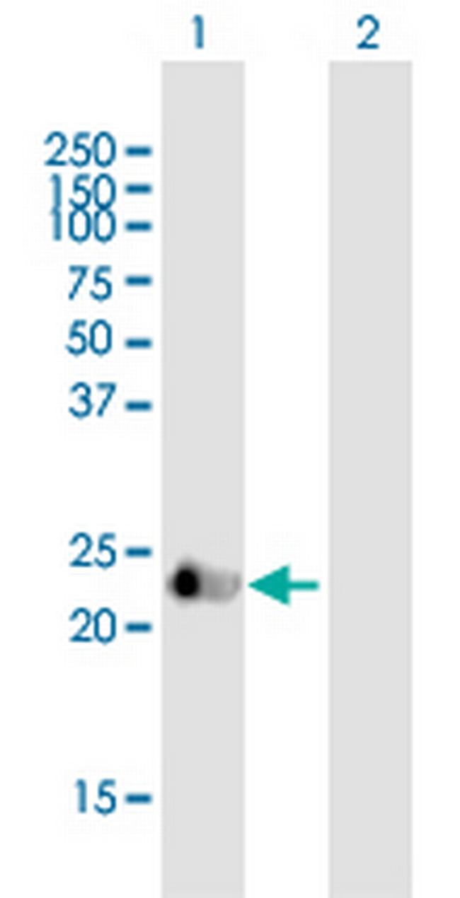 VASH1 Antibody in Western Blot (WB)