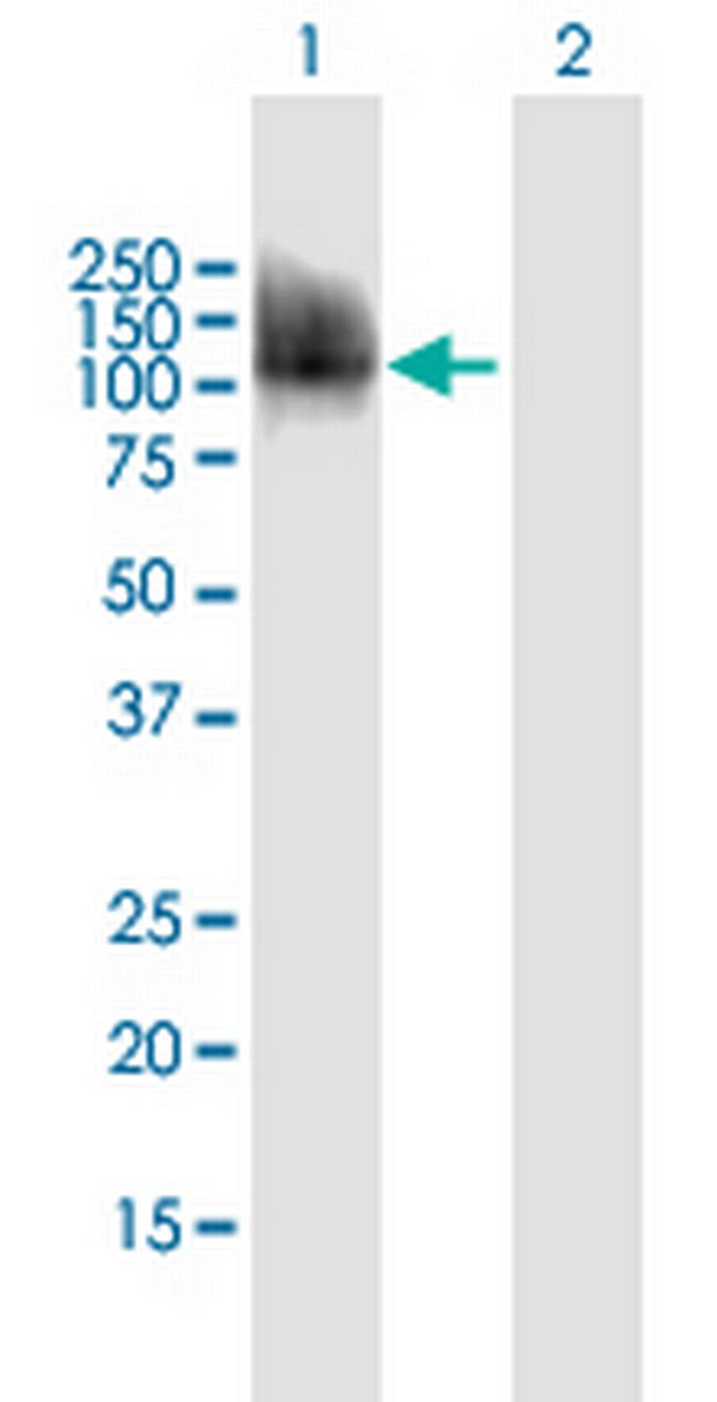 CPEB3 Antibody in Western Blot (WB)