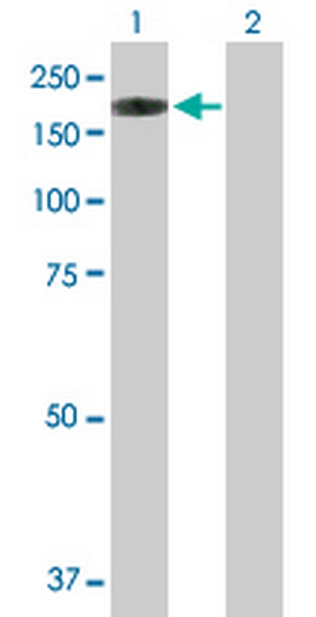 NLRP1 Antibody in Western Blot (WB)