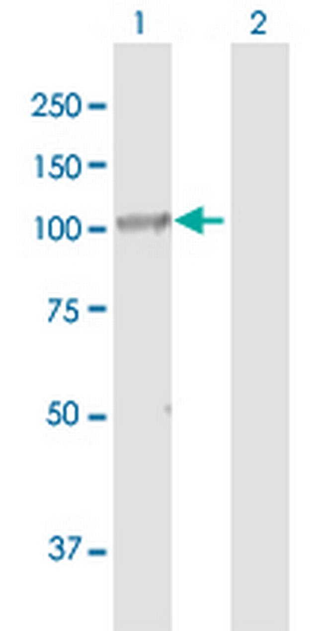 DIS3 Antibody in Western Blot (WB)