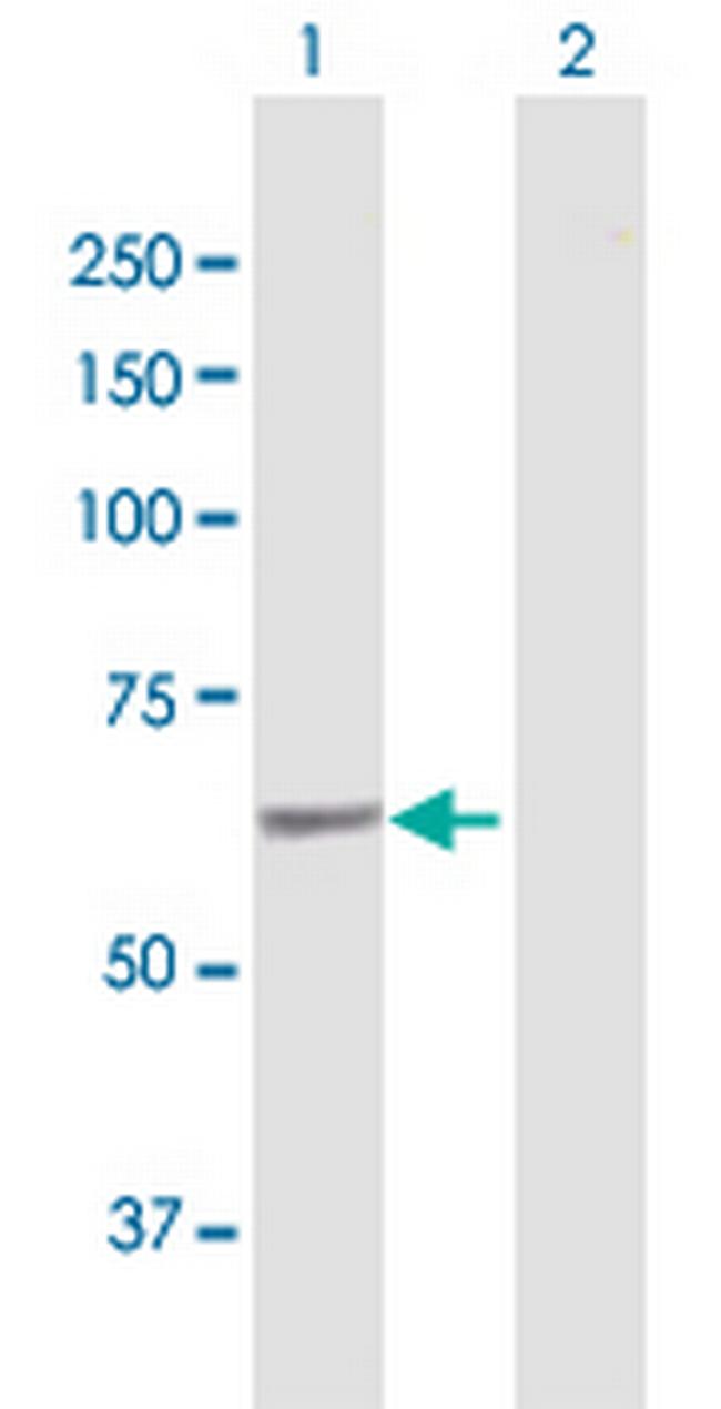 SACM1L Antibody in Western Blot (WB)