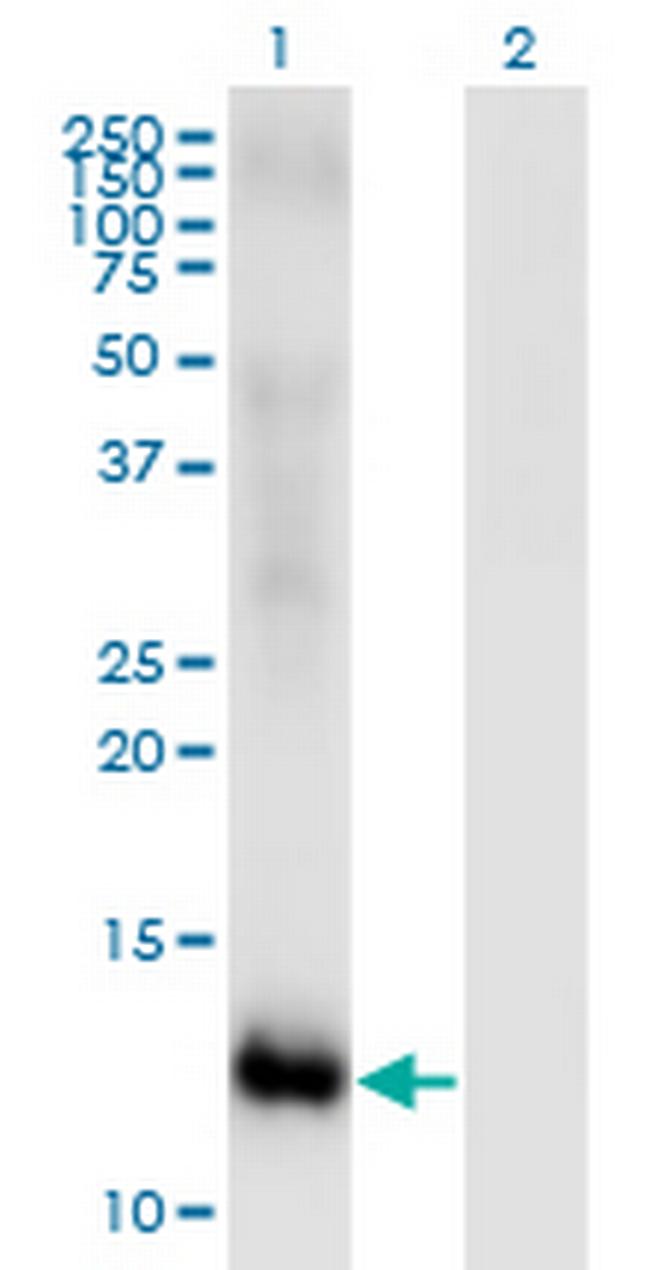 MSRB2 Antibody in Western Blot (WB)